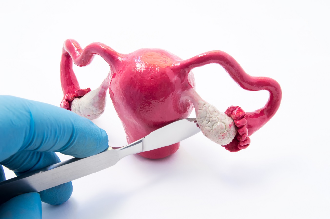 Doctor doing gynec procedure in Dallas, TX